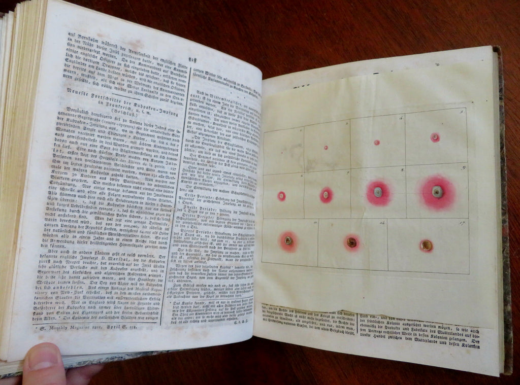 Medical smallpox vaccination color plate 1801 Allgemeine Zeitung German book
