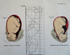 Pregnancy Child Birth Delivering Children 1912 Lot x 5 color prints Displayable